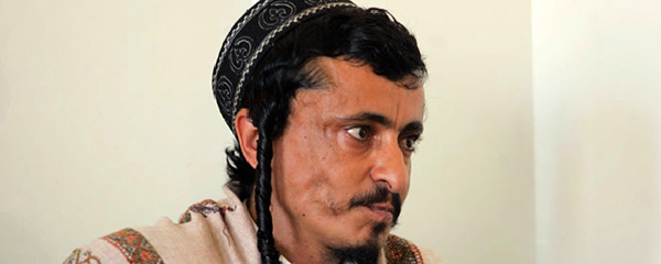 US State Department Reiterates Call for Immediate Release of Jewish Man Held Captive by Iranian-Backed Houthi Rebels in Yemen
